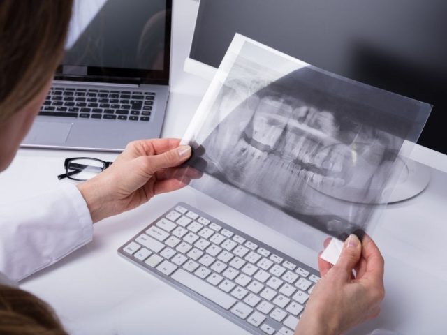 trattamento-disturbi-neuromuscolari-ml-dental-3 trattamento disturbi neuromuscolari